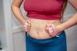 Kako da se rešim viška kože posle porođaja