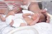 Beba, inkubator, bolnica