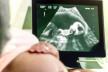 Ultrazvuk, trudnoća