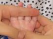Masaža bebinog dlana