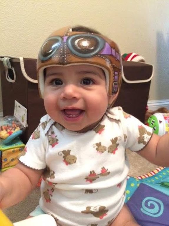 zabavne-igracke-ili-korektivne-kacige-za-bebe-foto