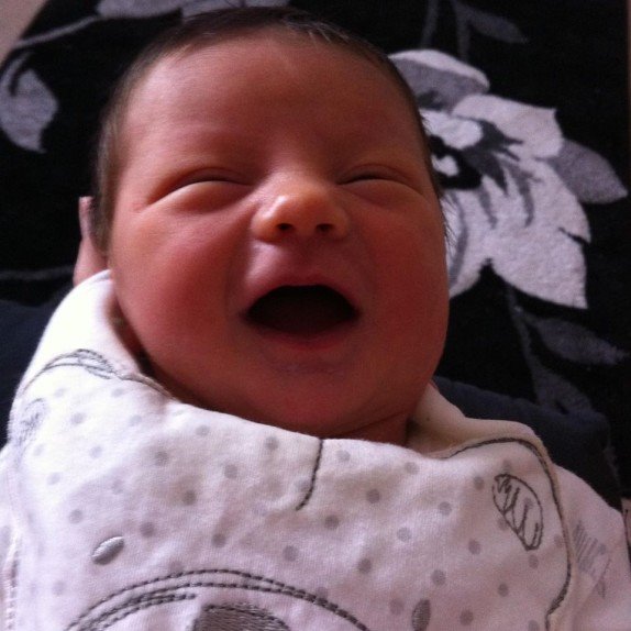 rodjena-beba-koja-je-prezivela-pokusaj-abortusa