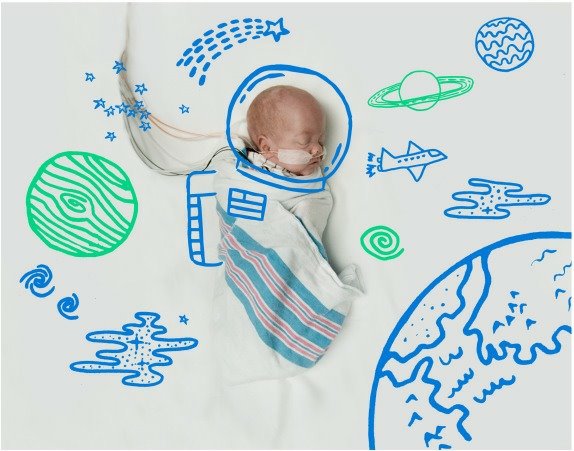 neodoljivo-veliki-snovi-prevremeno-rodjenih-beba-foto