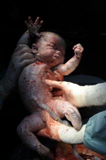 predivno-ili-uzasno-kako-bebe-izgledaju-u-trenutku-rodjenja