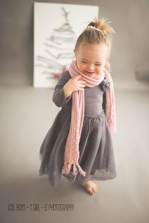 borba-sa-predrasudama-hrabra-majka-prikazuje-lepotu-dece-sa-smet