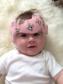 zabavne-igracke-ili-korektivne-kacige-za-bebe-foto