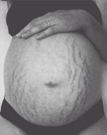 novi-trend-na-drustvenim-mrezama-ponosne-na-strije-foto