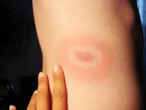 zdravlje-deteta-12-simptoma-koje-ne-bi-trebalo-ignorisati