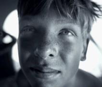 zabrinjavajuce-slike-uv-kamera-pokazala-kako-sunce-unistava-kozu