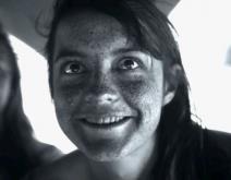 zabrinjavajuce-slike-uv-kamera-pokazala-kako-sunce-unistava-kozu