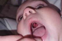 Beba, nalepnica, rascep