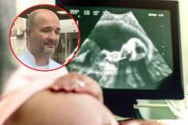 Primarijus doktor Mirko Mačkić, specijalista ginekologije sa akušerstvom