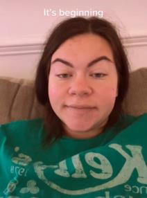 Trudnoća, nos, otok