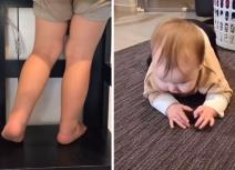 Medicinska sestra simptomi detetu slomljena kost.