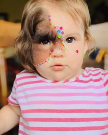 Devojčica sa mladežom preko lica