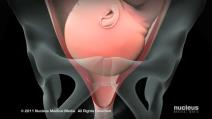 Nucleus Medical Media - Patient Education Animation Labor and Vaginal Birth [ZDP_ewMDxCo - 1250x703 - 1m00s].png