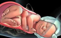 Kako izgleda prirodni porođaj1111.jpg