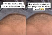 bebi pulsira fontanela.jpg