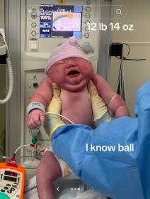 Žena rodila krupnu bebu