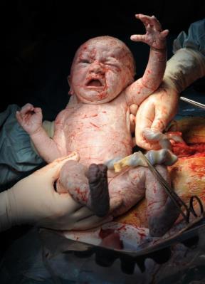 predivno-ili-uzasno-kako-bebe-izgledaju-u-trenutku-rodjenja