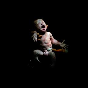 fotografije-iz-operacione-sale-bebe-uslikane-nekoliko-sekundi-na