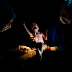 fotografije-iz-operacione-sale-bebe-uslikane-nekoliko-sekundi-na