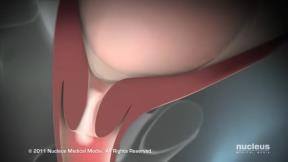 Nucleus Medical Media - Patient Education Animation Labor and Vaginal Birth [ZDP_ewMDxCo - 1250x703 - 0m35s].png