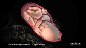 Nucleus Medical Media - Patient Education Animation Labor and Vaginal Birth [ZDP_ewMDxCo - 1250x703 - 1m06s].png