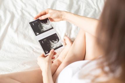 Trudnoća, trudnica, ultrazvuk