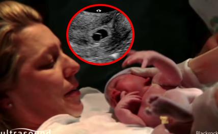 Beba, mama, ultrazvuk
