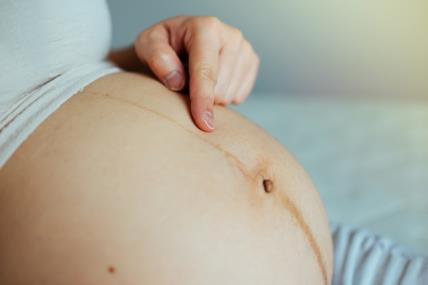Linea nigra, tamna linija na stomaku, trudnoća