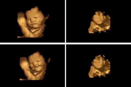 ultrazvuk-beba-trudnoća.jpg