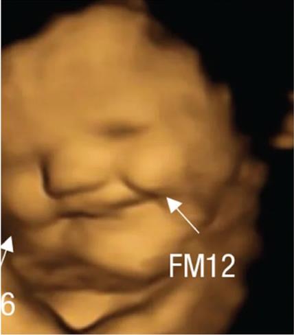 beba-smeje-ultrazvuk.jpg
