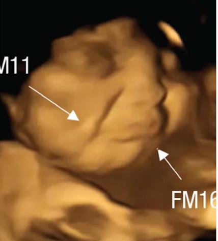 beba-ultrazvuk-mršti.jpg