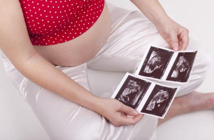 Trudnica, trudnoća, ultrazvuk, blizanci