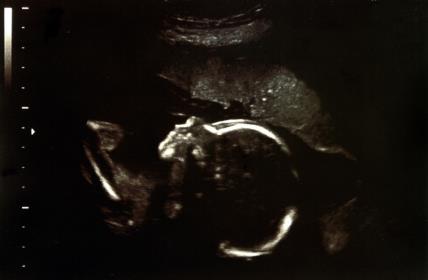 ultrazvuk.jpg