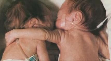 Babica spasila život prevremeno rođenim bliznakinjama.