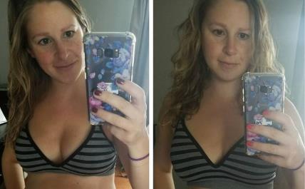 Kako izgleda mama posle porođaja.