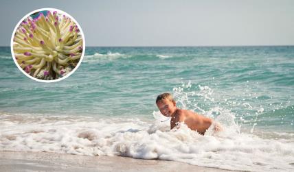 Dečaka opekla morska sasa u Grčkoj.