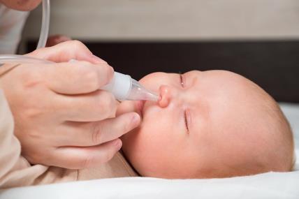 Kako da lečite curenje nosa kod bebe.