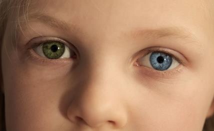 Dete sa različitom bojom očiju_1836551467.jpg