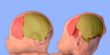 Šta se dešava sa bebinom glavom tokom porođaja.jpg