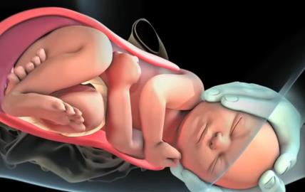 Kako izgleda prirodni porođaj1111.jpg