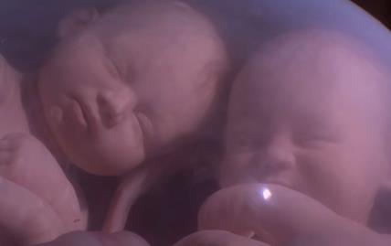 Ispovest mame koja je trudna sa mono-mono blizancima.