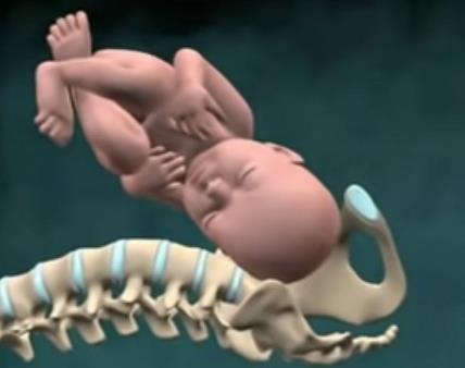 Distocija ramena na porođaju snimak.