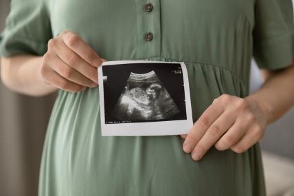 kako izgleda razvoj bebe od začeća do porođaja.jpg