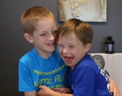 Dečak objasnio zašto je njegov brat sa Daunovim sindromom poseban