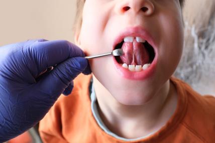 Koje govorne probleme može da reši stomatolog