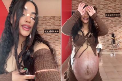 trudnica sa ogromnim stomakom nosi blizance.jpg