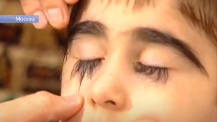 Dečak sa najdužim trepavicama na svetu.jpg